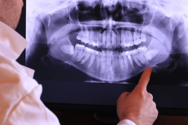 Best Walk-In Emergency Dental Services in Terryville, CT
