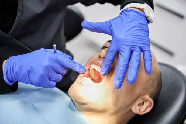 Best Emergency Treatment for Oral Infections in Terryville, CT