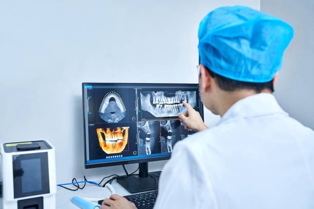 Best Knocked-Out Tooth (Avulsed Tooth) Treatment in Terryville, CT